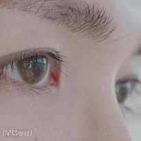 他又嘆道，阿MO的身體已近三年五個月無法活動。