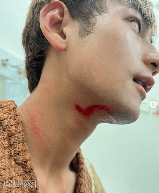Jeffrey冧爆說女友每日幫他消毒。