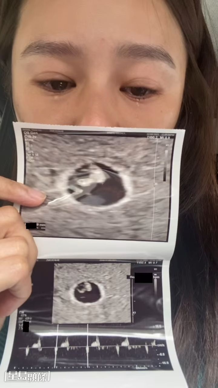 黄翠如今日正式怀孕。