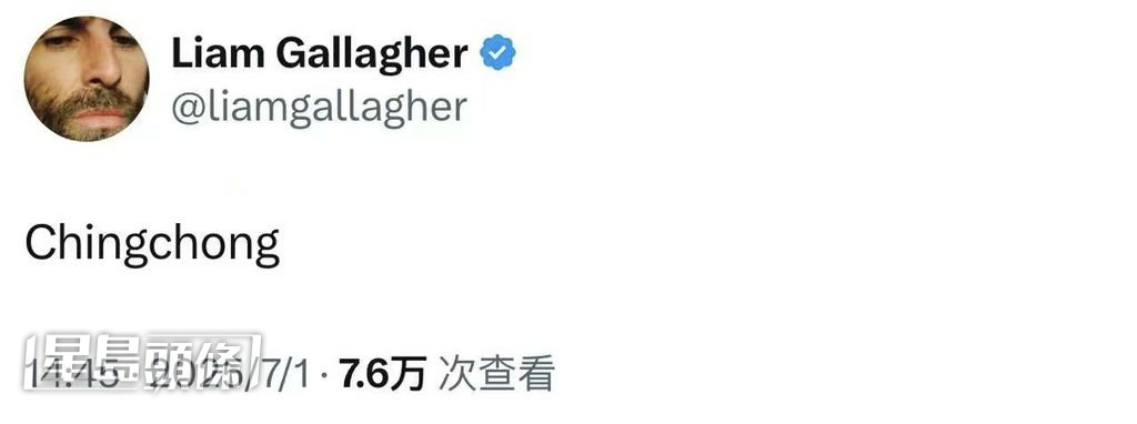 Liam昨日突然在社交平台X上，上傳了「Chingchong」這個辱華詞彙。