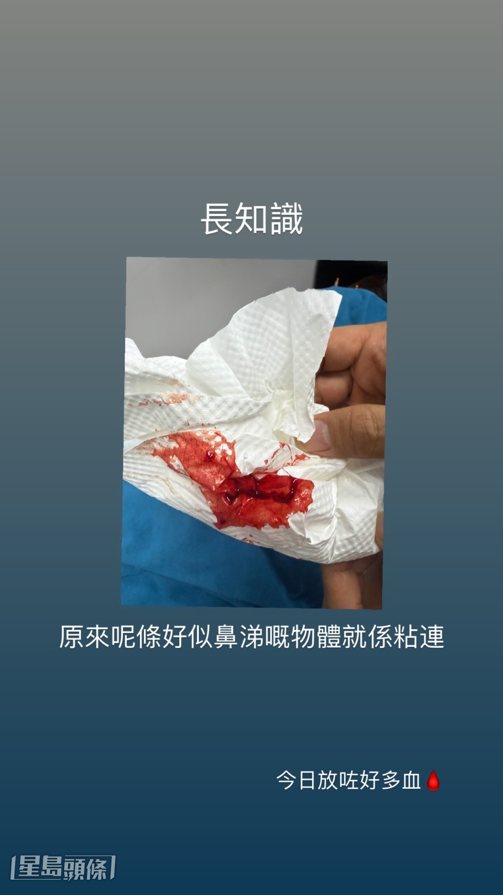 Gin早前於IG Post了染血相片,嚇到粉絲狂問咩事。 Gin早前於IG Post了染血相片,嚇到粉絲狂問咩事。