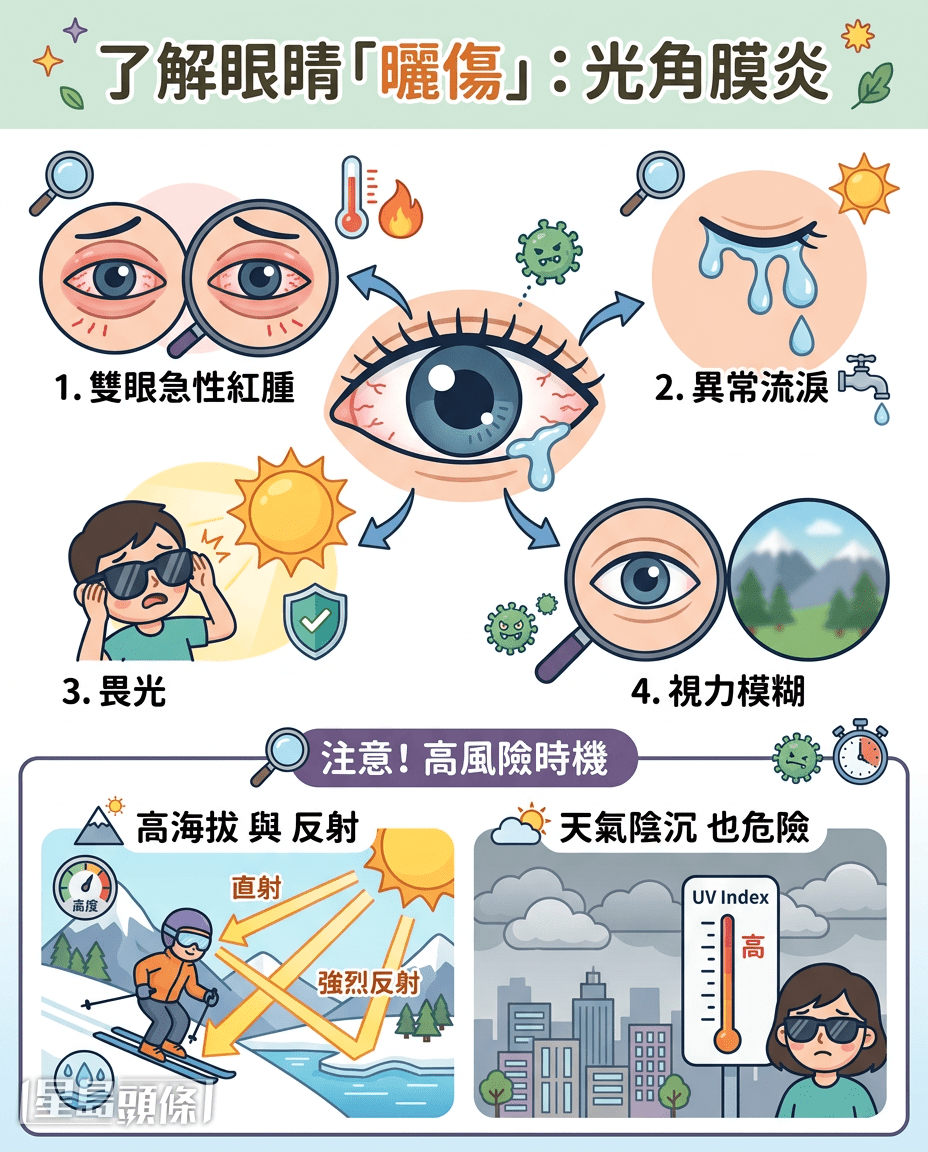 眼睛曬傷會造成光角膜炎