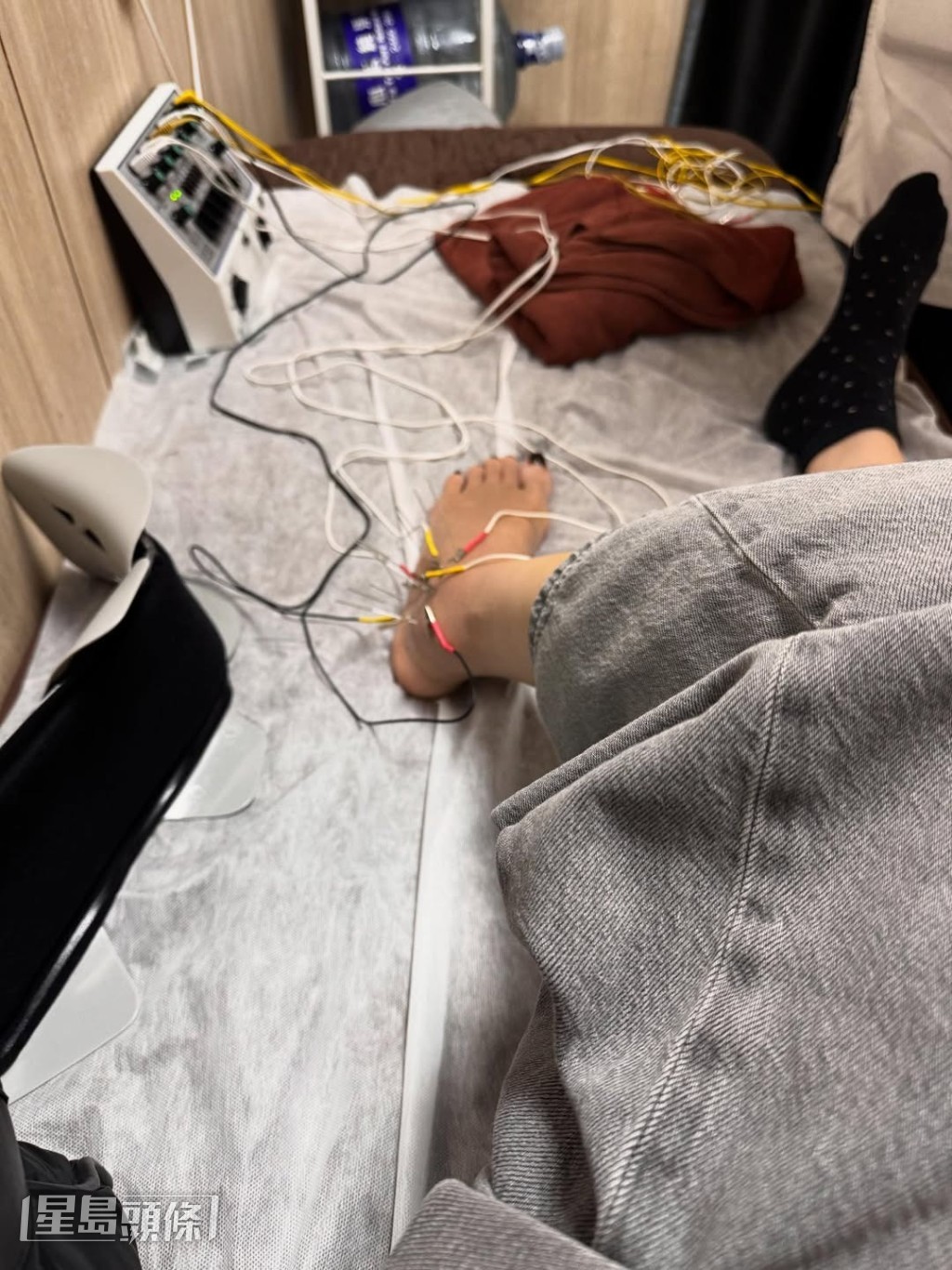 余安安晒出左腳接受治療的照片。 余安安晒出左腳接受治療的照片。