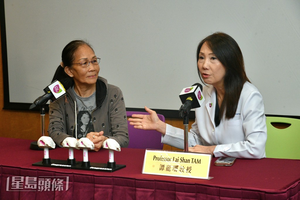 中大醫學院內科及藥物治療學系講座教授及風濕科主管譚麗珊。 中大醫學院內科及藥物治療學系講座教授及風濕科主管譚麗珊。