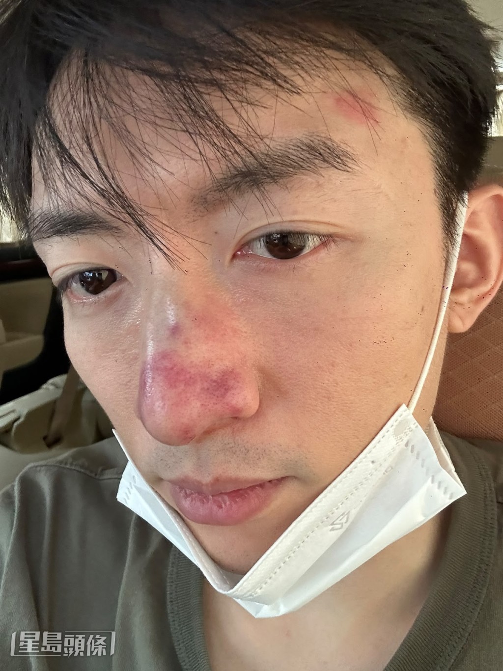 當時譚坤倫覺得小問題,因見過好多前輩都覺得小事。(獨家圖片) 當時譚坤倫覺得小問題,因見過好多前輩都覺得小事。(獨家圖片)