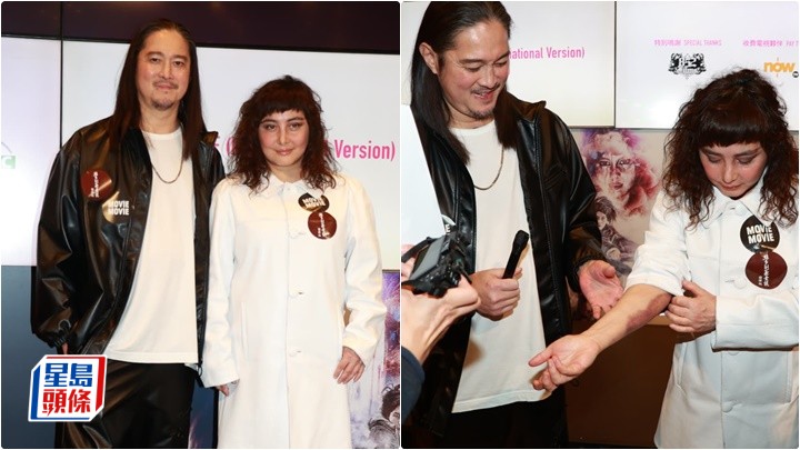 何超儀拍吊威也戲滿手瘀痕  陳子聰透露身體狀況良好  暫未能做心臟主動脈手術