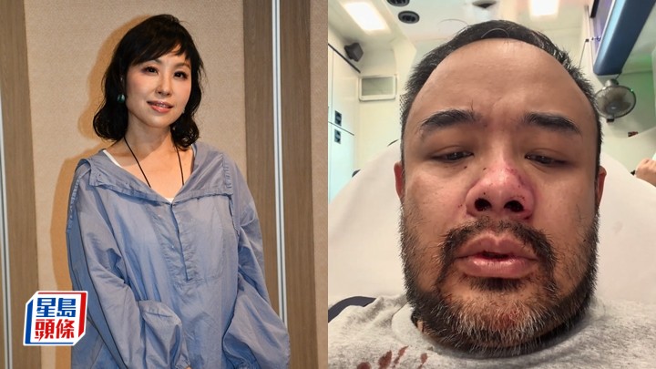 蝦頭楊詩敏愕然回應前度邵子風遇襲：多年冇聯絡緣盡難強求。