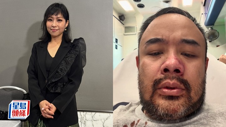 蝦頭楊詩敏舊愛邵子風直播遇襲斬纜回應：佢人生自己負責 預告明年出書講人生後半場。