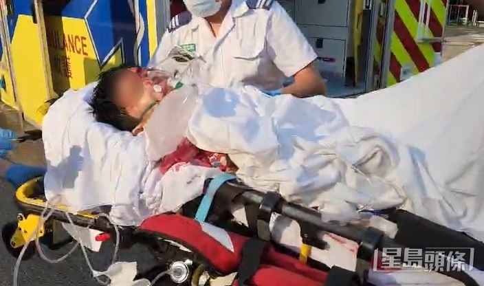 26歲男子血流披臉送院。