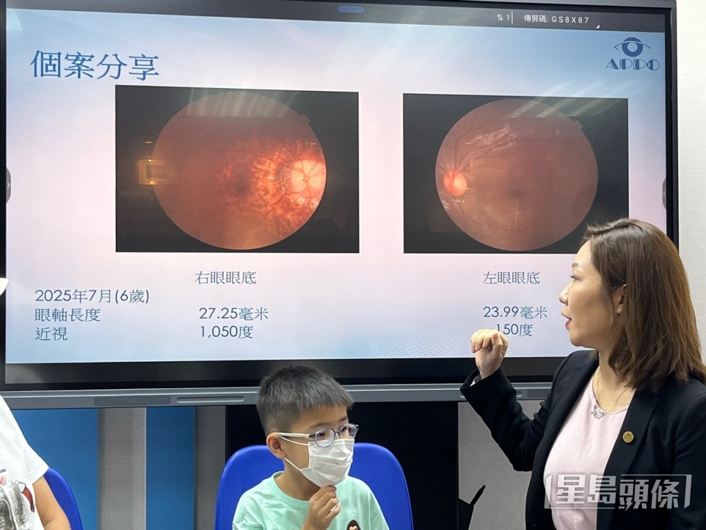 香港執業眼科視光師協會發表「到校視力篩查結果及近視預測新指標」。