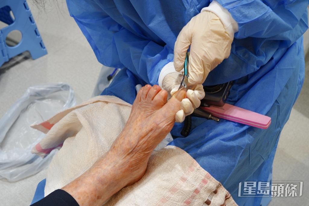 吳詠珊指出，不少長者將腳甲剪得過短，可能導致甲溝炎、倒甲，甚至是具傳染性的灰甲。