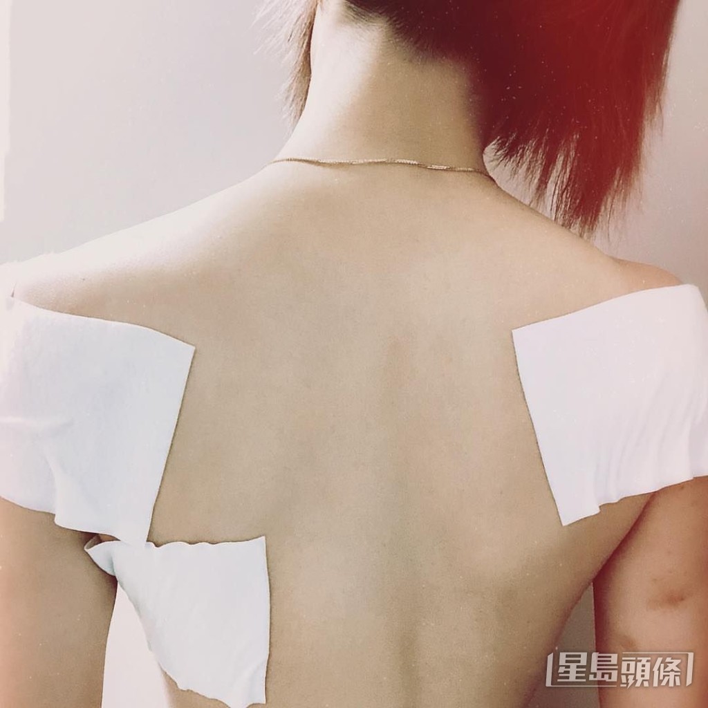 龔嘉欣劇集《殺手》的動作場面積極受訓，以致背脊瘀傷。