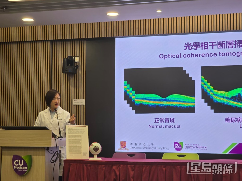 中大醫學院眼科及視覺科學學系教授張艷蕾。 中大醫學院眼科及視覺科學學系教授張艷蕾。