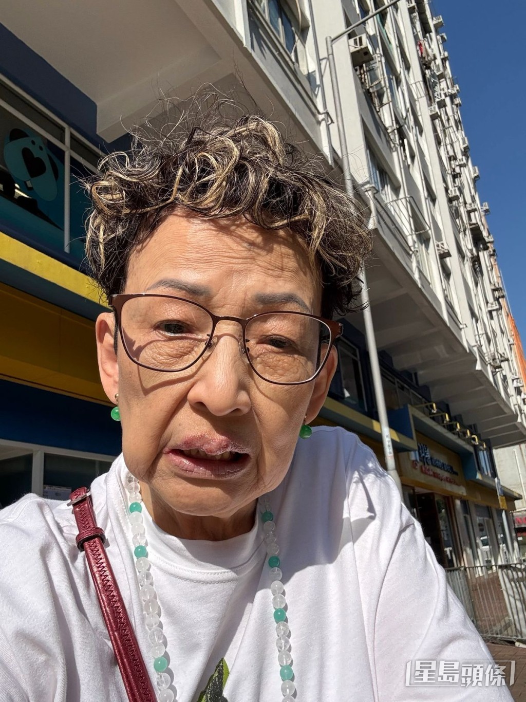 經歷了三天治療終病癒。