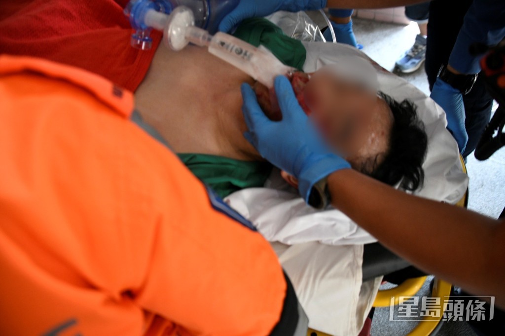 有跑手昏迷送院。 有跑手昏迷送院。