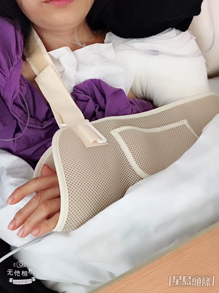 2018年肩膊韌帶斷裂做手術。
