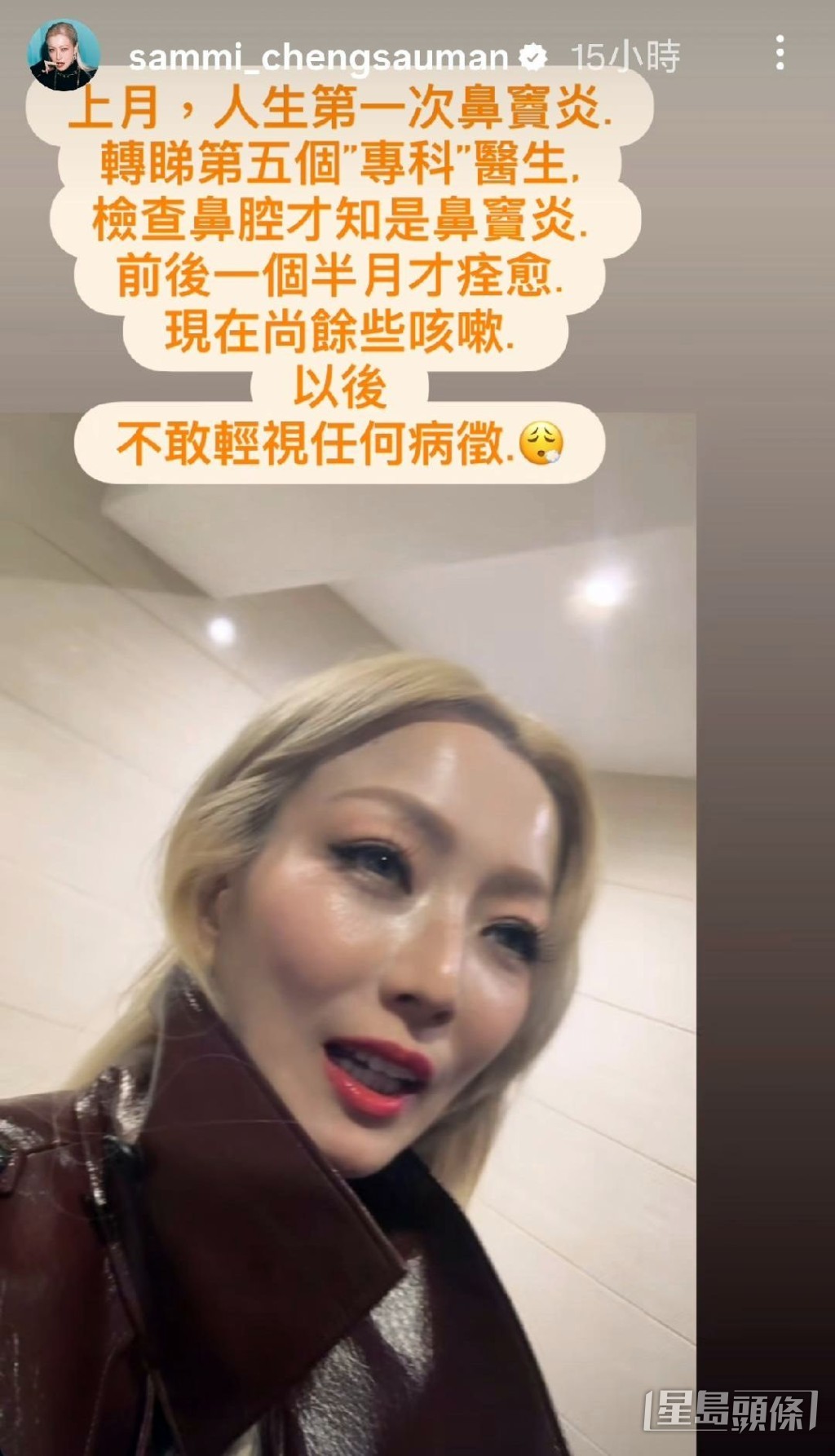 Sammi上月首患鼻竇炎。
