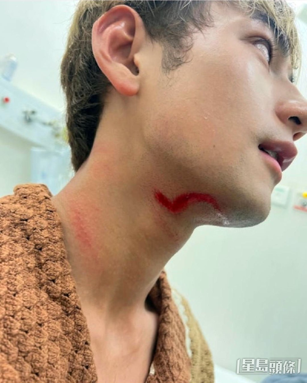 Jeffrey拍攝期間頸部曾受傷。