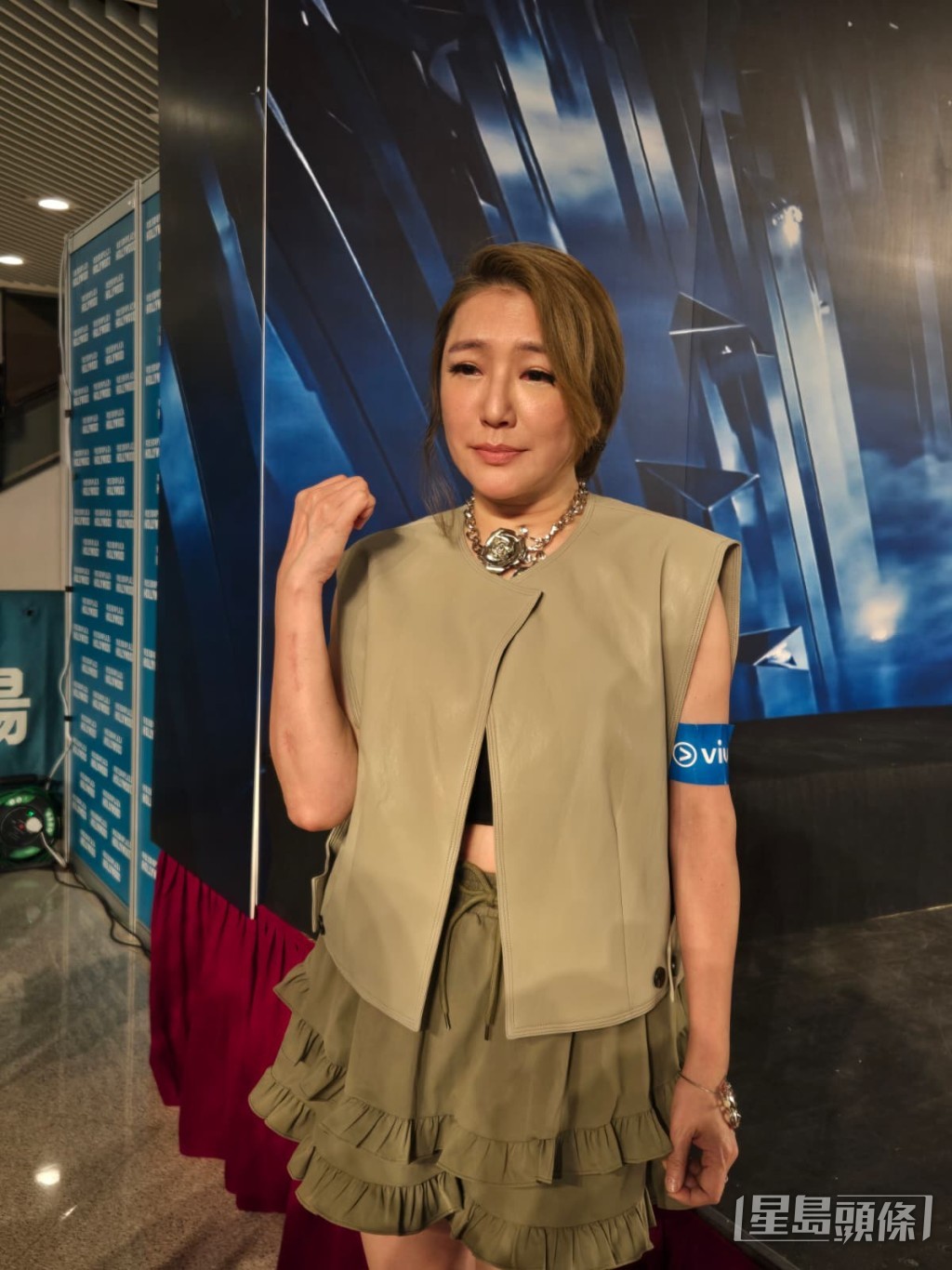 關寶慧展示交通意外後傷勢。 關寶慧展示交通意外後傷勢。