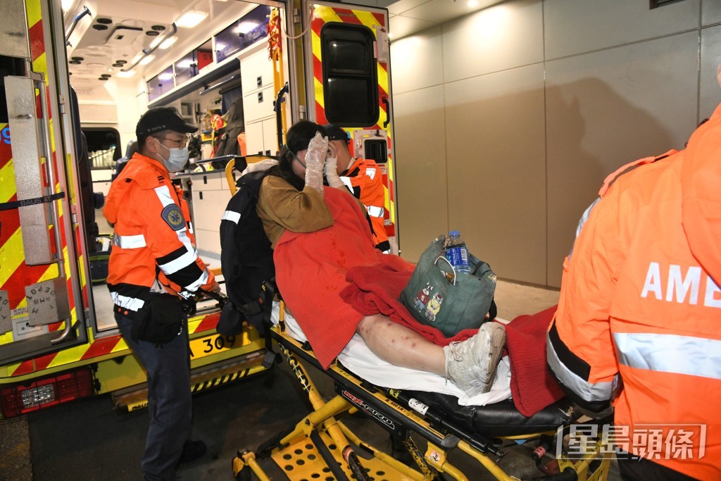 起火單位40歲女住戶手腳燒傷送院。