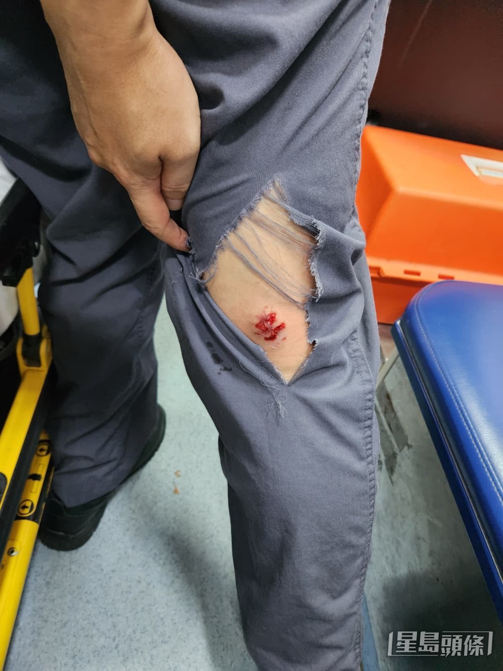 9月11日,一名郵差在米埔派信時突遭狗隻從後撲上,腰部及左腳被咬傷送院。(張偉權提供) 9月11日,一名郵差在米埔派信時突遭狗隻從後撲上,腰部及左腳被咬傷送院。(張偉權提供)