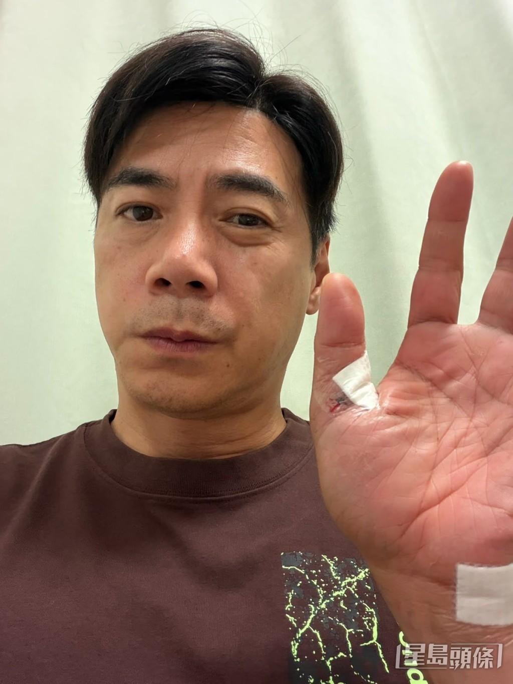 崔錦棠車禍出院後面青青露面。 崔錦棠車禍出院後面青青露面。