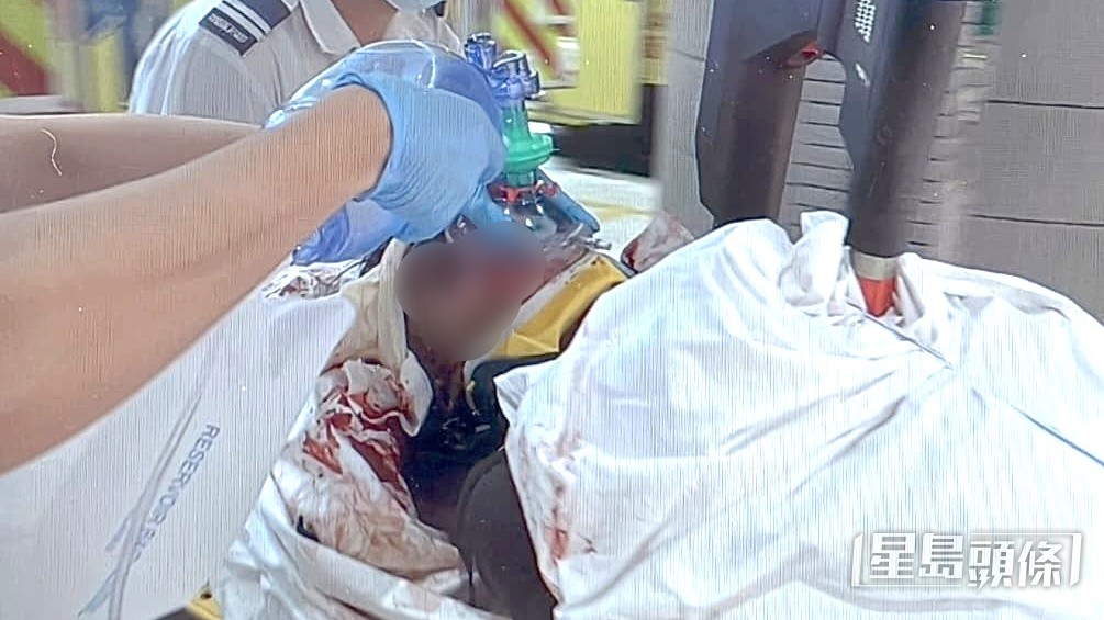 重創工人送院死亡。