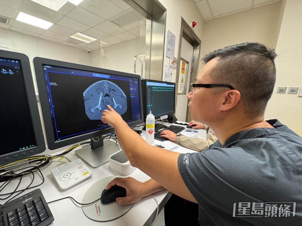 影像解剖採用電腦掃描、超聲波掃描及磁力共振的影像技巧。