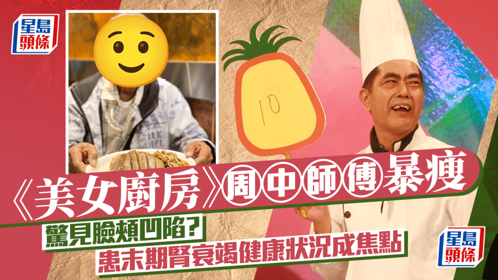 《美女廚房》周中師傅暴瘦近照曝光驚見臉頰凹陷 患末期腎衰竭健康狀況成焦點