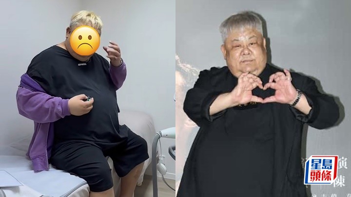 61歲林雪臉爆恐怖黑斑健康惹隱憂   拍片解神秘「胎記」之謎與竟瞓覺有關