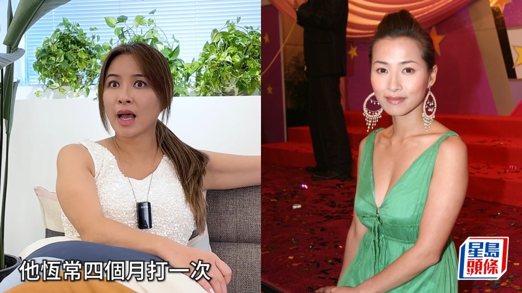 麥家琪坦認做醫美保高顏值  從「最憎」變打針常客：唔靚接受唔到  拆解身體微調部位