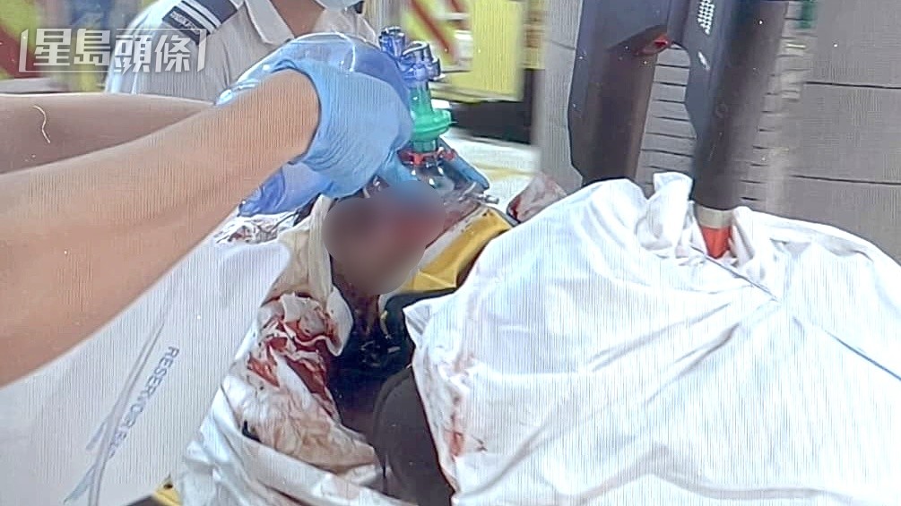 重創工人送院死亡。 重創工人送院死亡。
