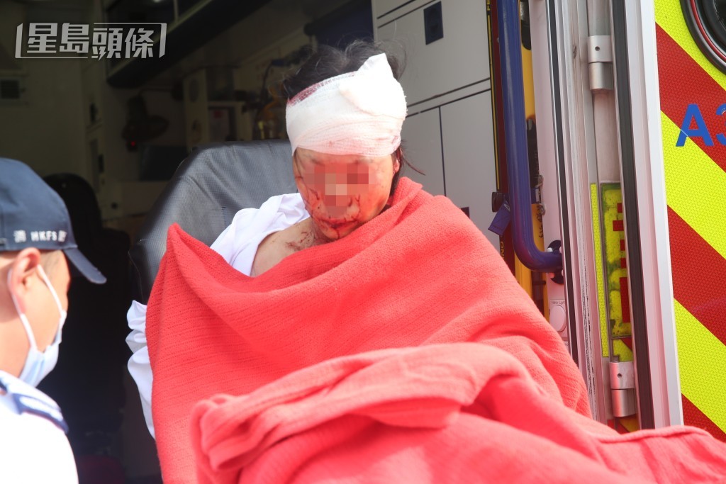 事件中黃家四姊妹同告受傷，其中長姊與五妹離世。資料圖片