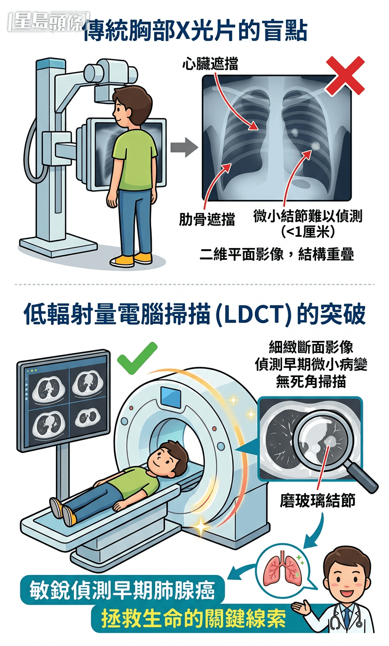 突破传统X光盲点