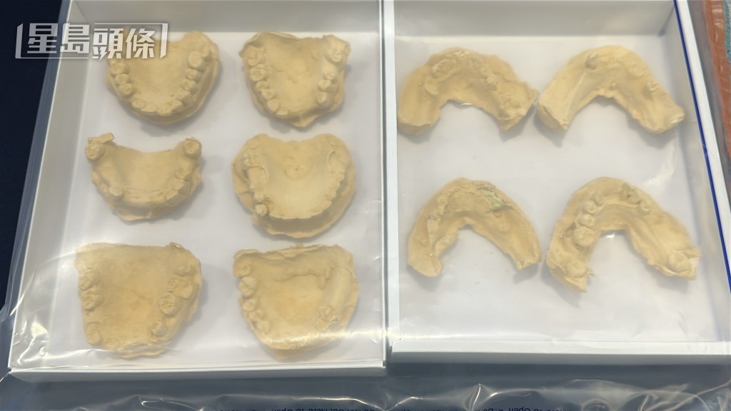 入境處檢獲牙模等工具。劉漢權攝 入境處檢獲牙模等工具。劉漢權攝