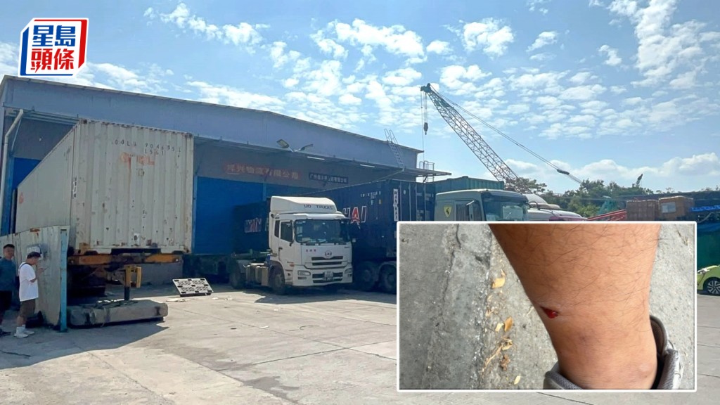 元朗壆圍西路一貨倉員被唐狗咬傷小腿。