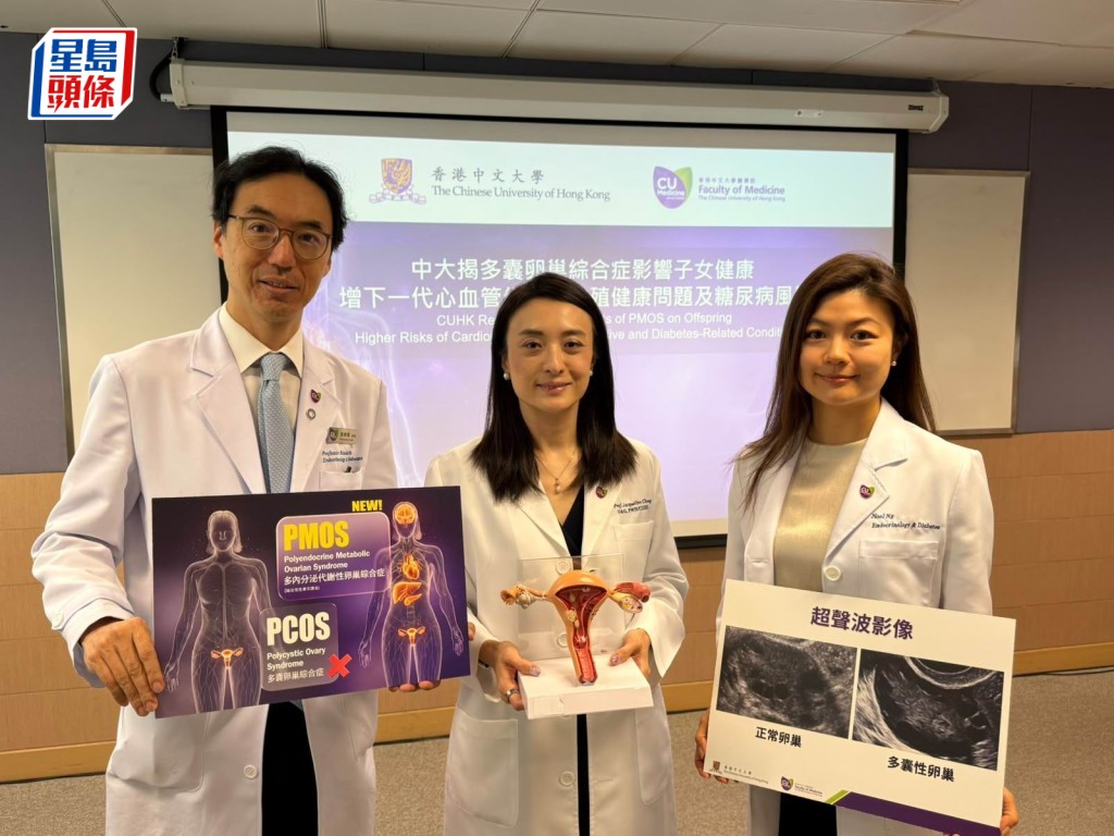 中大醫學院研究發現，「多內分泌代謝性卵巢綜合症」不單會影響患者自身，亦會令病人後代的月經失調、心血管疾病風險上升。　伍萬庭攝