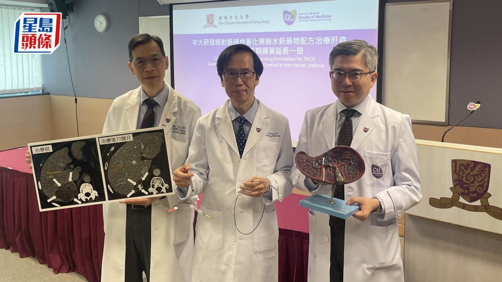 (左起)中大醫學院外科學系肝膽胰外科名譽臨床副教授李傑輝、中大醫學院影像及介入放射學系名譽臨床教授余俊豪、中大醫學院腫瘤學系教授陳林。