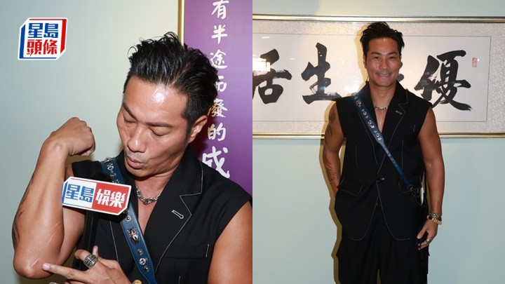 「亞視古天樂」黃竣鋒深圳遇刀手狂劈留疤︰去人多地方唔自在  拍《四大探長》戒打喊到變豬頭