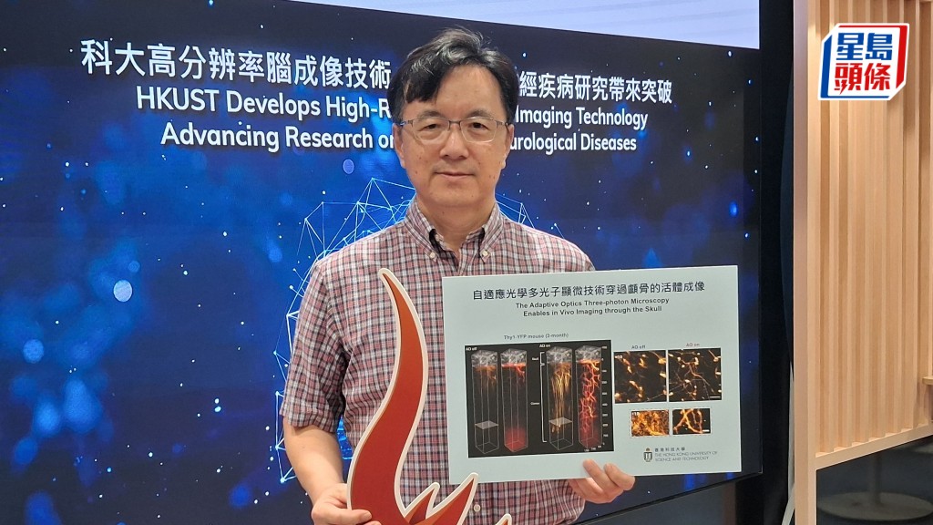 由科大工學院電子及計算機工程學系教授瞿佳男所領導的團隊成功開發MD-FSS技術，令測量時間較原有技術的速度提升10倍以上，並可實時追蹤大腦動態。歐文瀚攝