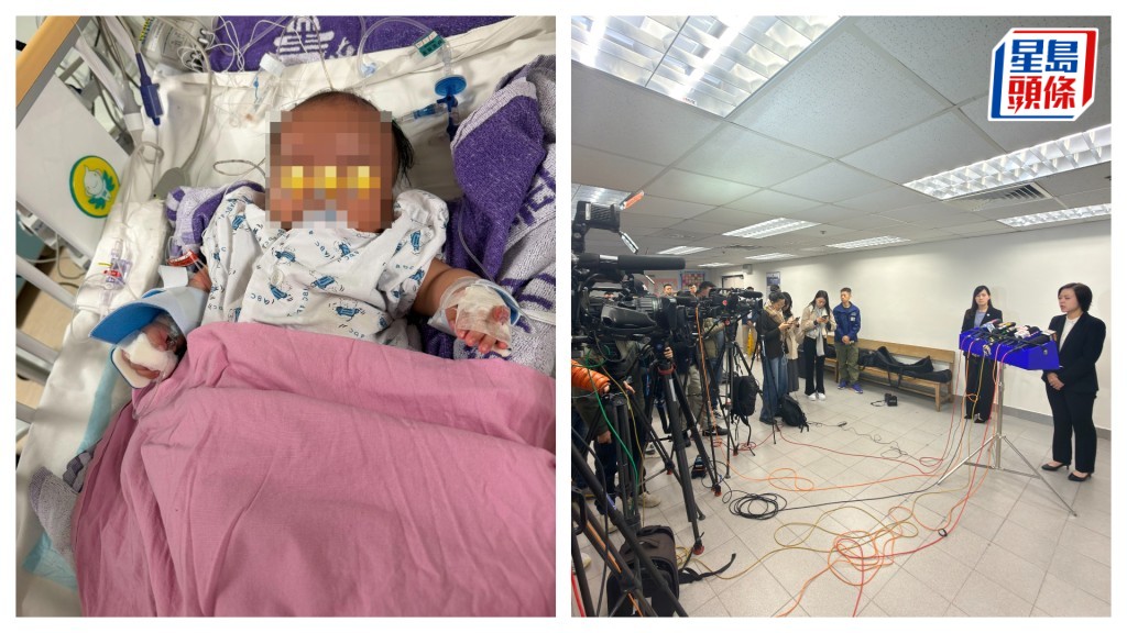 4歲男嬰疑受虐留醫兒童ICU，警方交代案件。