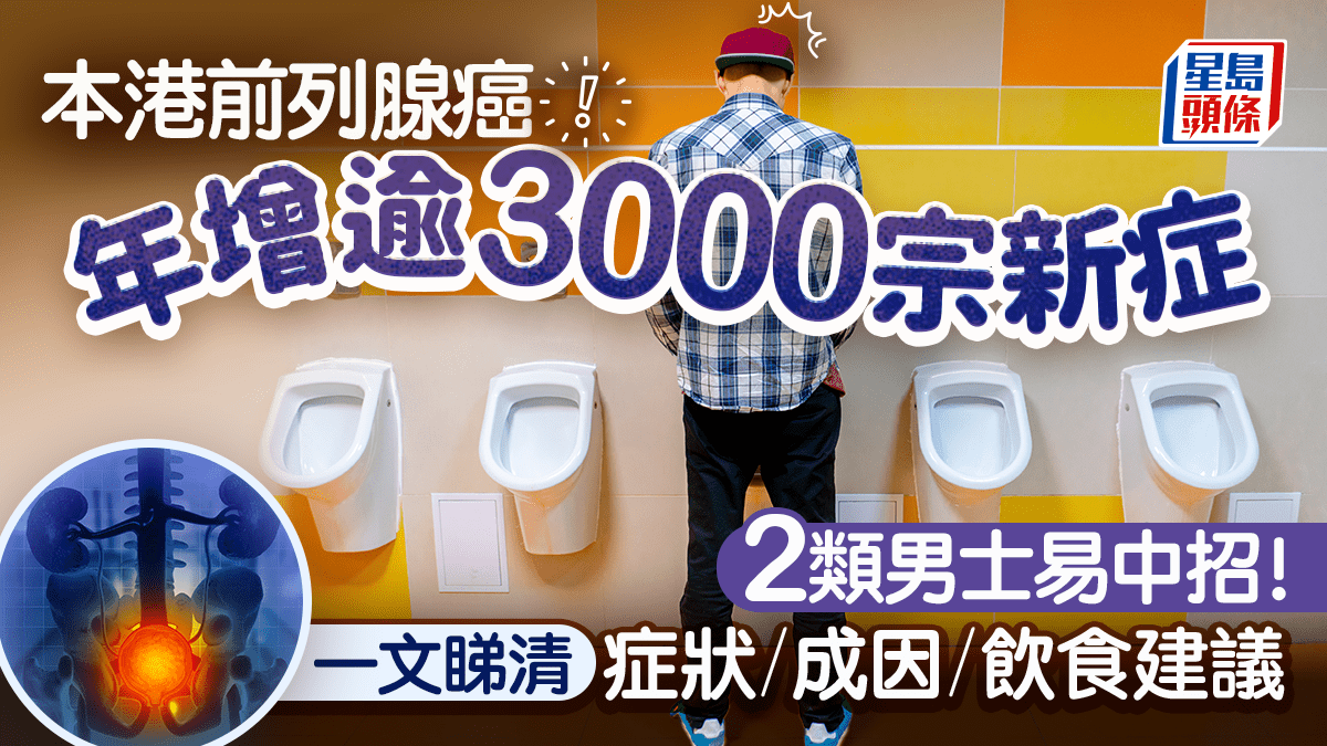 本港前列腺癌年增逾3000宗新症 2類男士易中招!一文睇清症狀/成因/飲食建議 本港前列腺癌年增逾3000宗新症 2類男士易中招!一文睇清症狀/成因/飲食建議