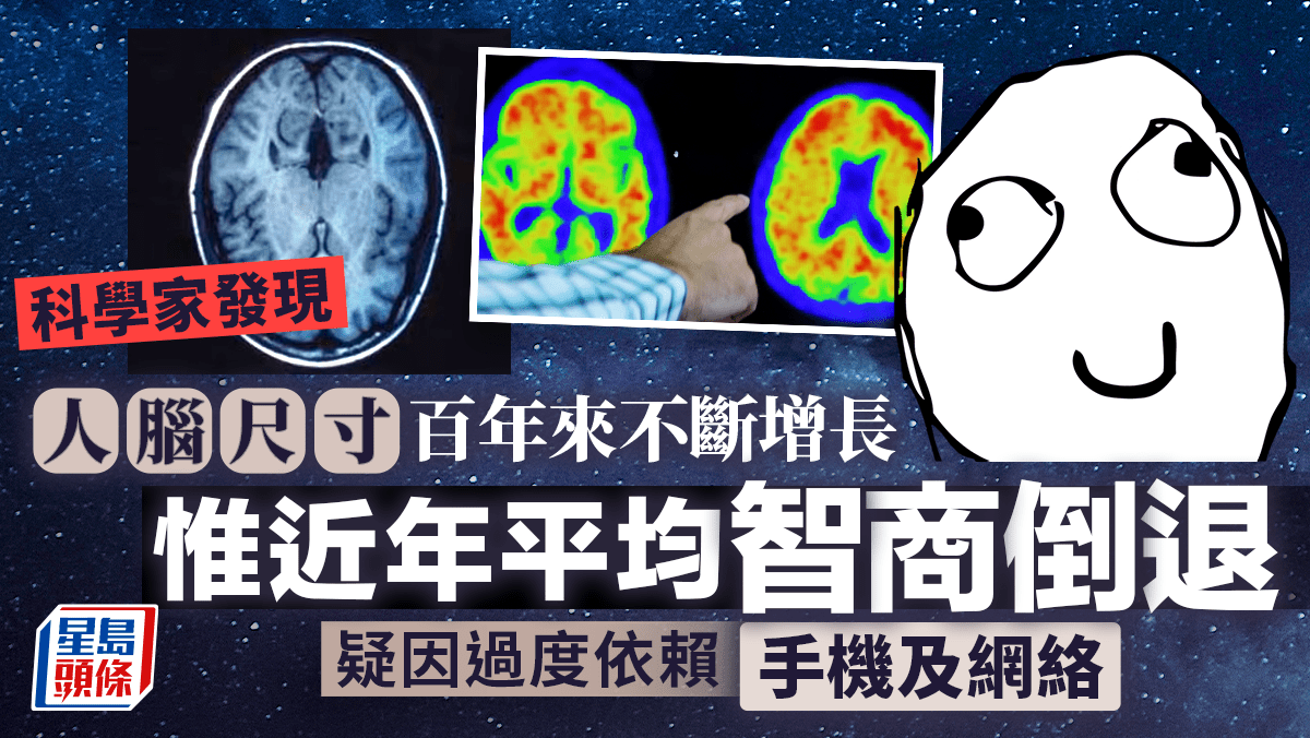 科學家發現人腦尺寸百年來不斷增長惟近年平均智商倒退