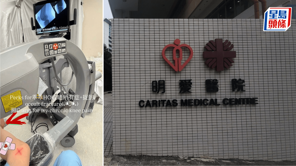 明愛醫院實習醫生擅取器材照X光 冠冕堂皇Po IG 醫管局紀律處分