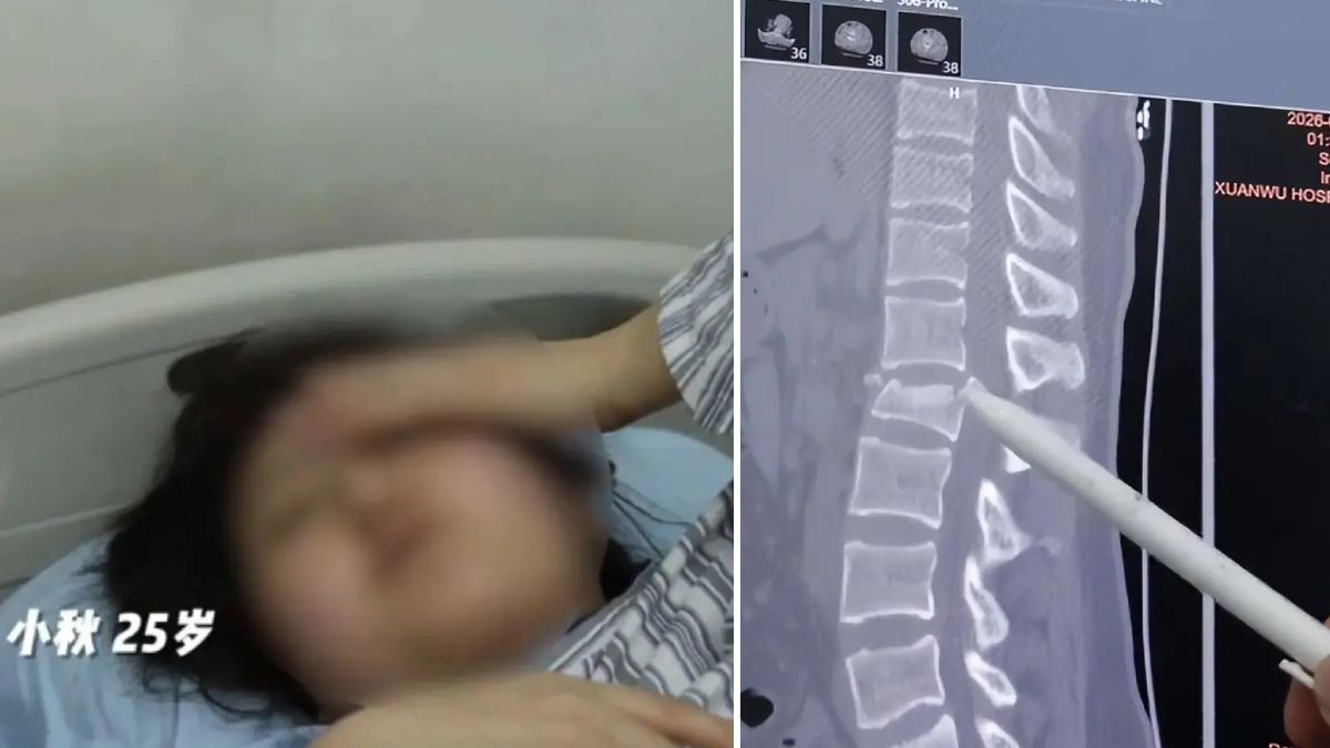 低頭族︱25歲女子落樓梯時玩手機摔倒 一度癱瘓大小便失禁