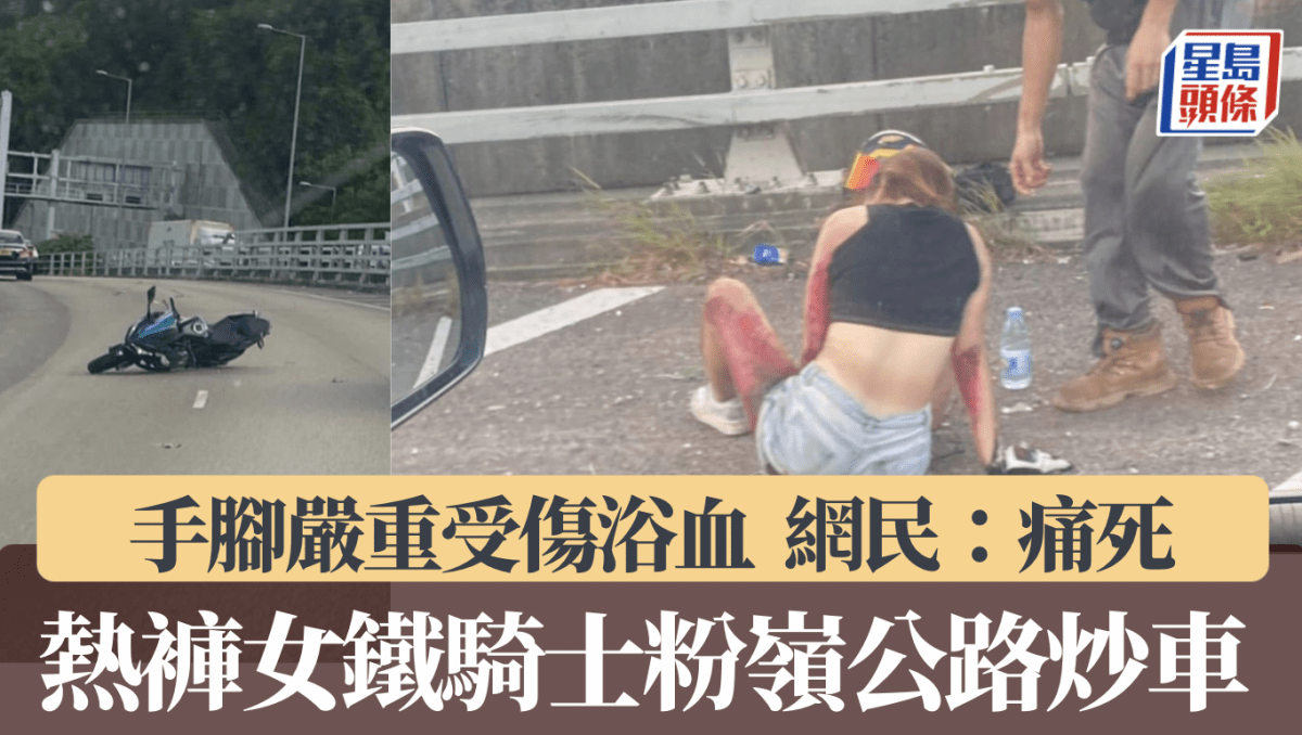 25歲熱褲女鐵騎士粉嶺公路自炒倒地 手腳大面積受傷浴血 網民:痛死