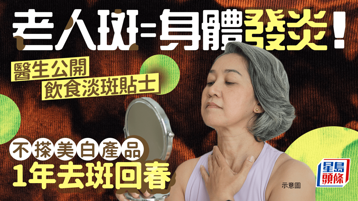 老人斑是身體發炎警號!醫生公開飲食淡斑貼士 不搽美白產品1年去斑回春 老人斑是身體發炎警號!醫生公開飲食淡斑貼士 不搽美白產品1年去斑回春