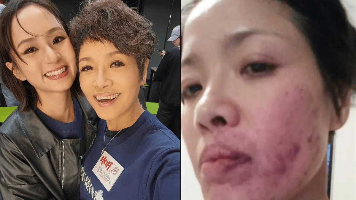 寶珮如重提拍戲被梁雍婷掌摑至紅腫瘀黑  出Po為後輩平反   曾認趕收工提出「真打」