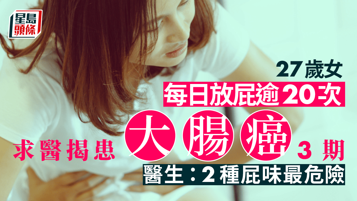 癌症|27歲女放屁逾20次揭患大腸癌 醫生:2種屁味最危險