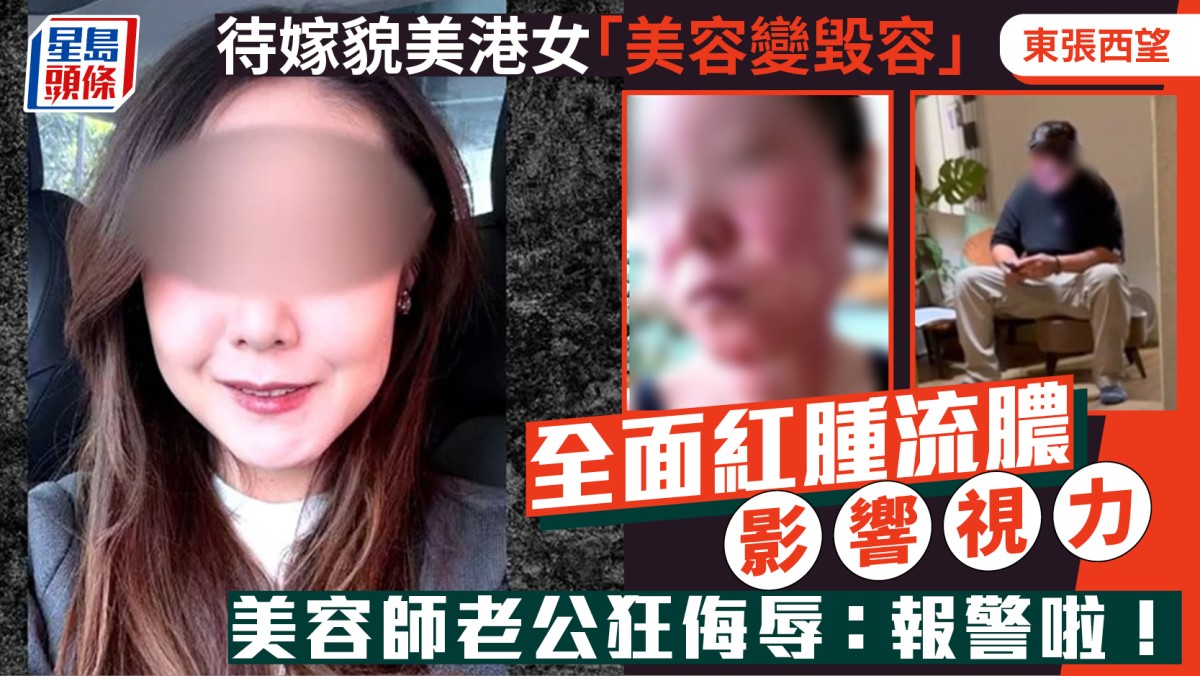 東張西望｜待嫁貌美港女「美容變毀容」  全面紅腫流膿影響視力  美容師老公狂侮辱：報警啦